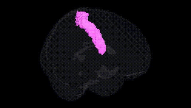 Full Brain Black