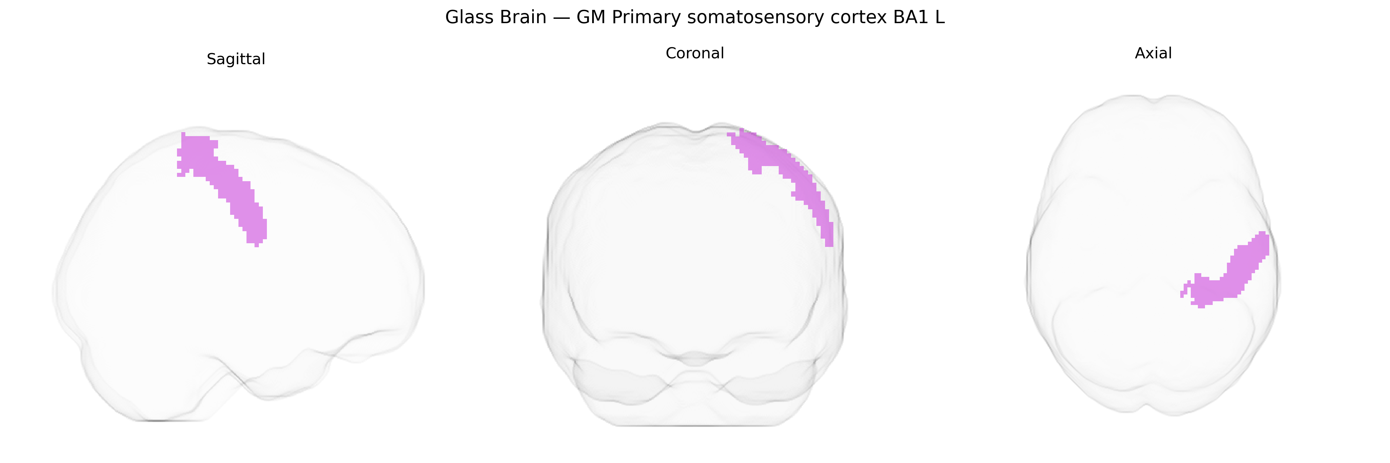 Triplanar Ghost Brain