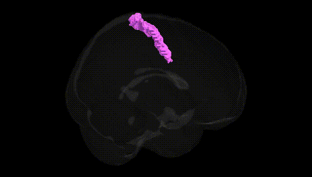 Full Brain Black