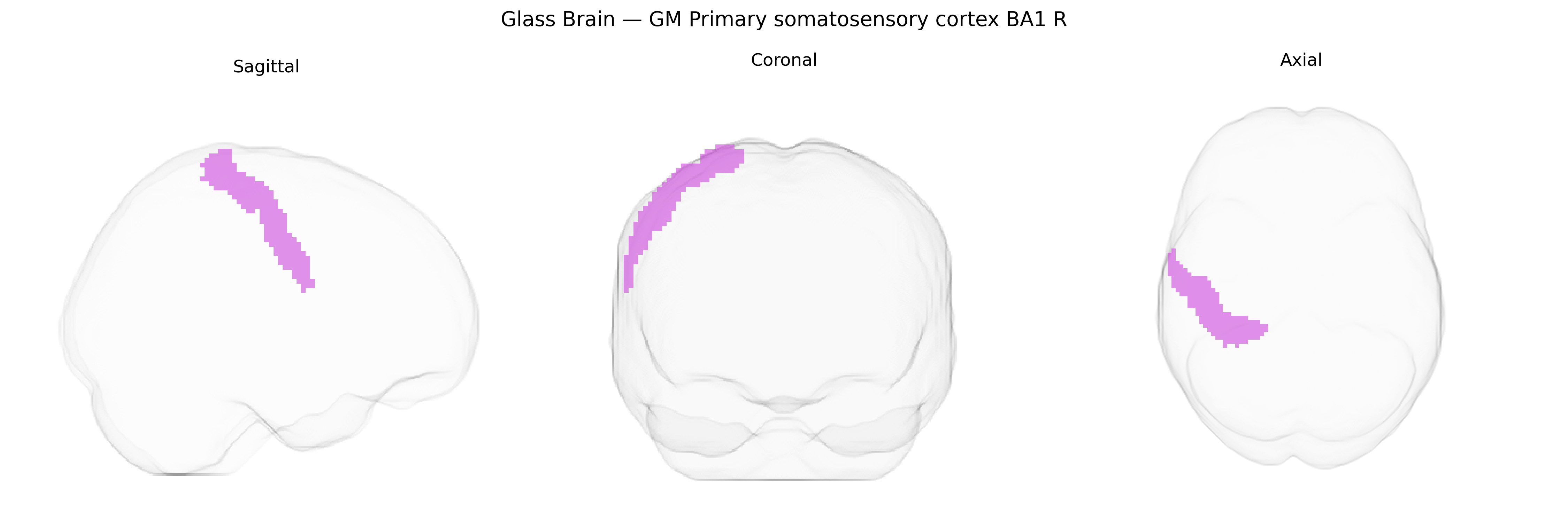 Triplanar Ghost Brain