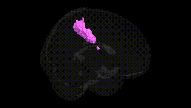 Full Brain Black