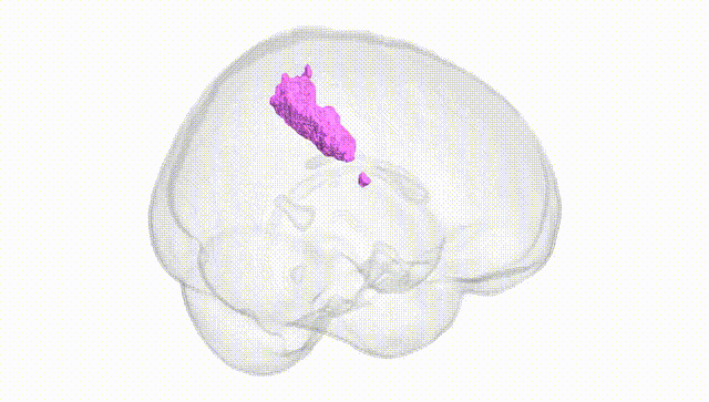 Full Brain White