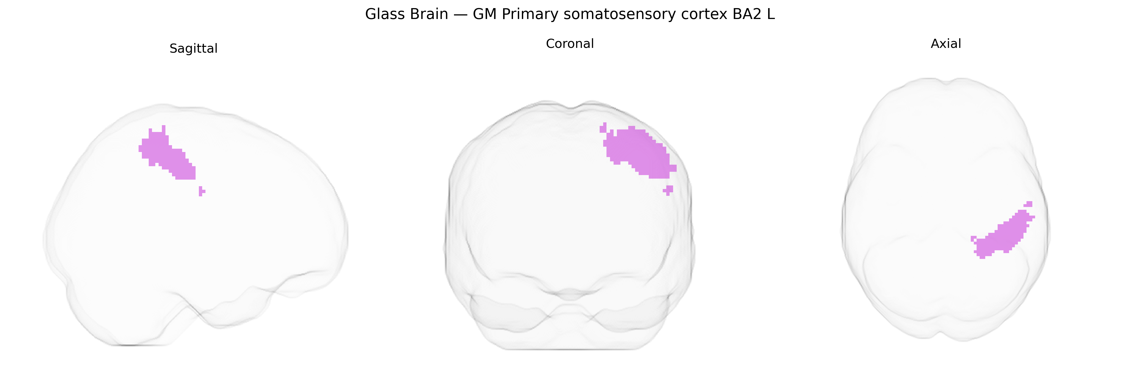 Triplanar Ghost Brain