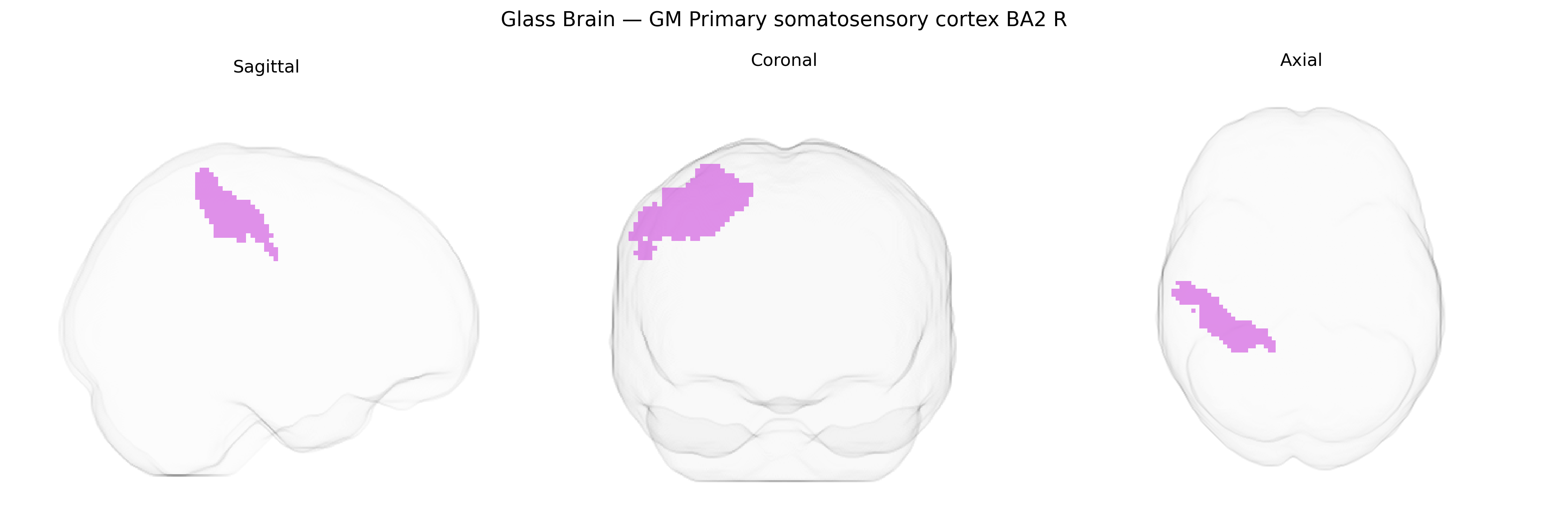 Triplanar Ghost Brain