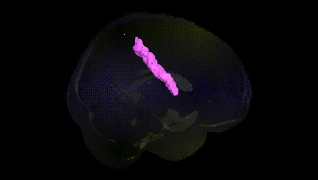 Full Brain Black