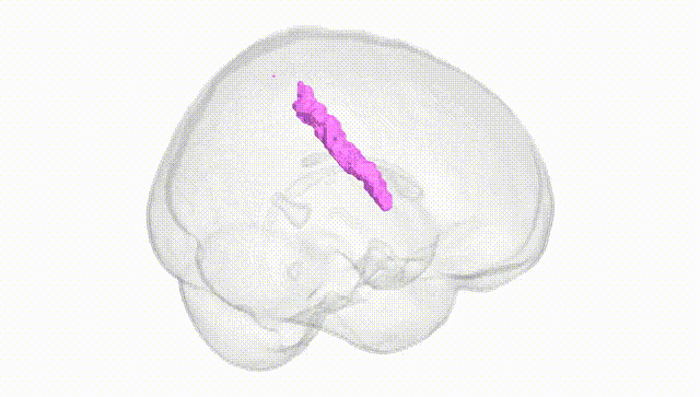 Full Brain White