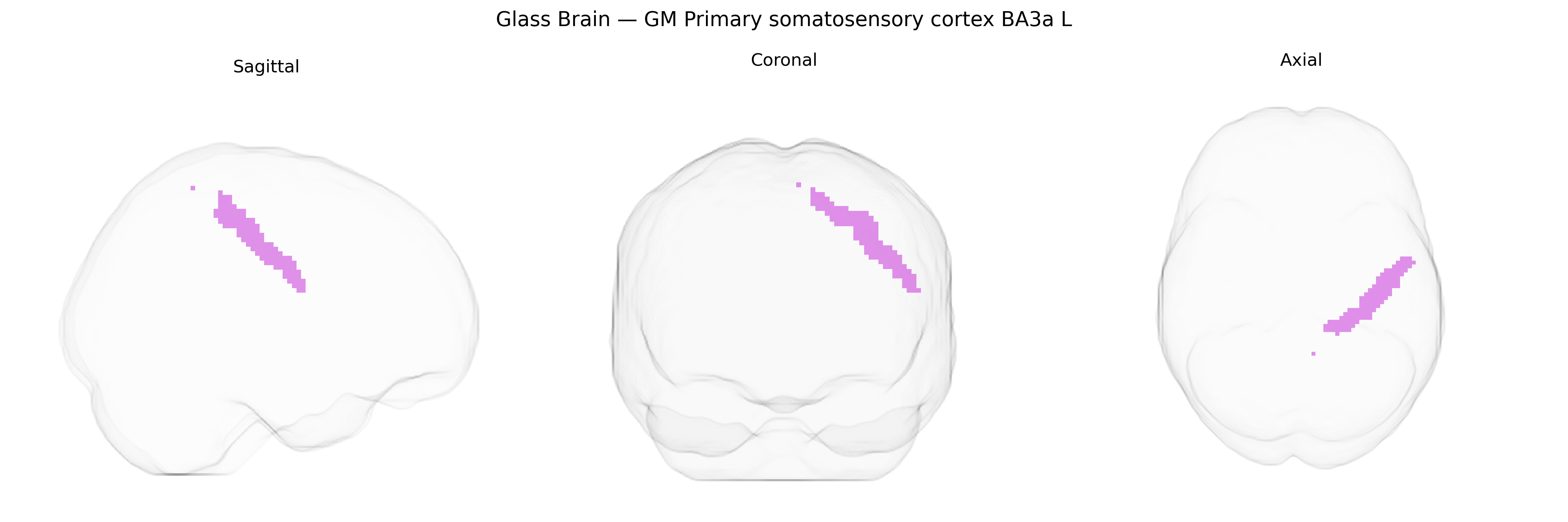 Triplanar Ghost Brain
