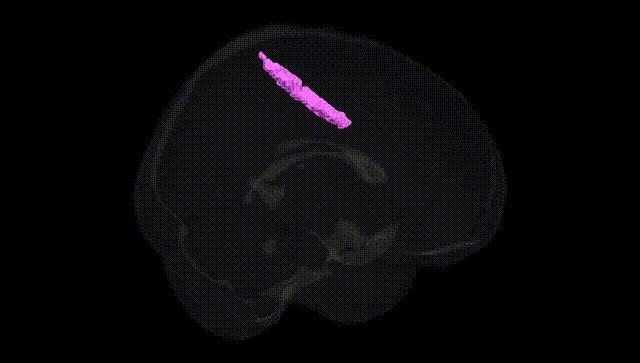 Full Brain Black