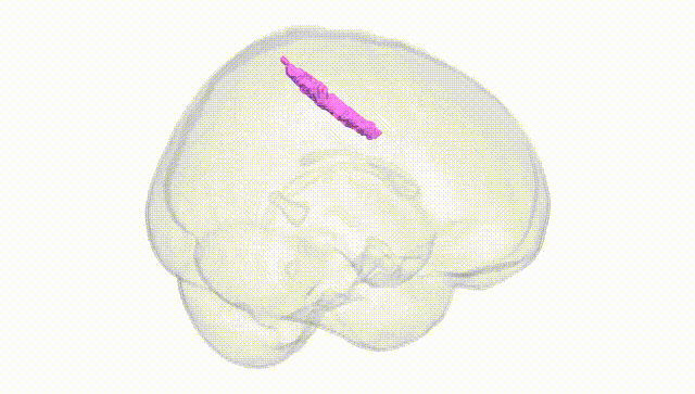 Full Brain White