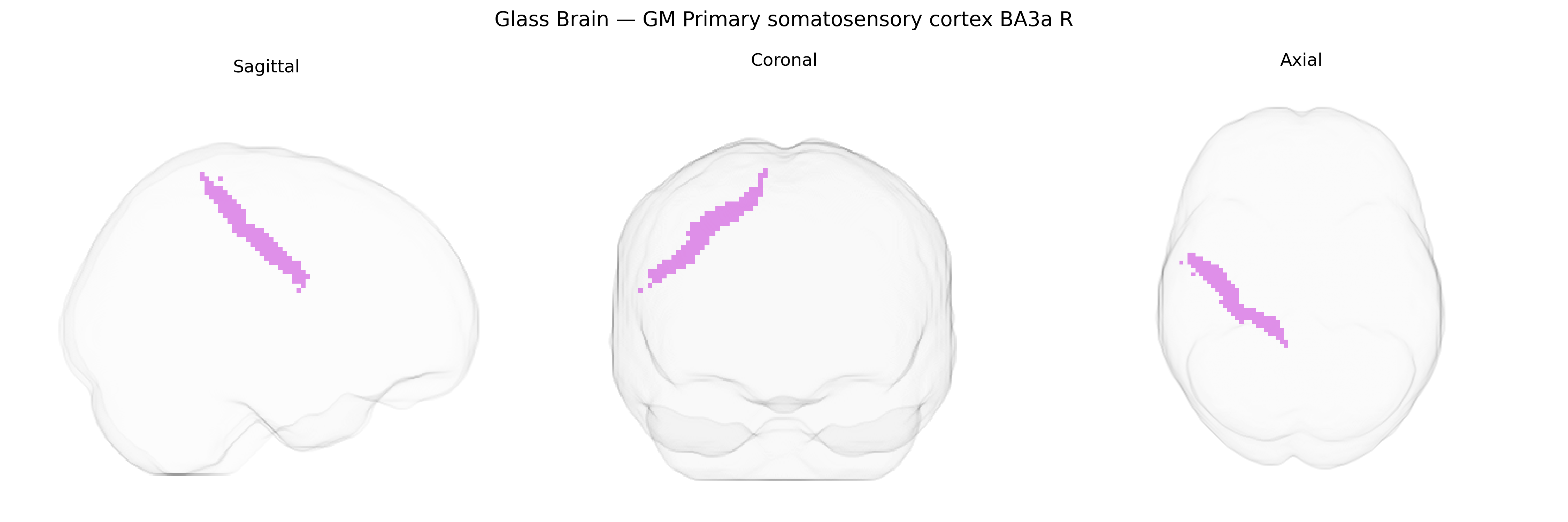 Triplanar Ghost Brain