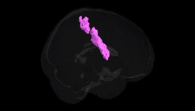 Full Brain Black