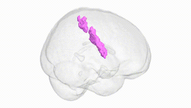 Full Brain White