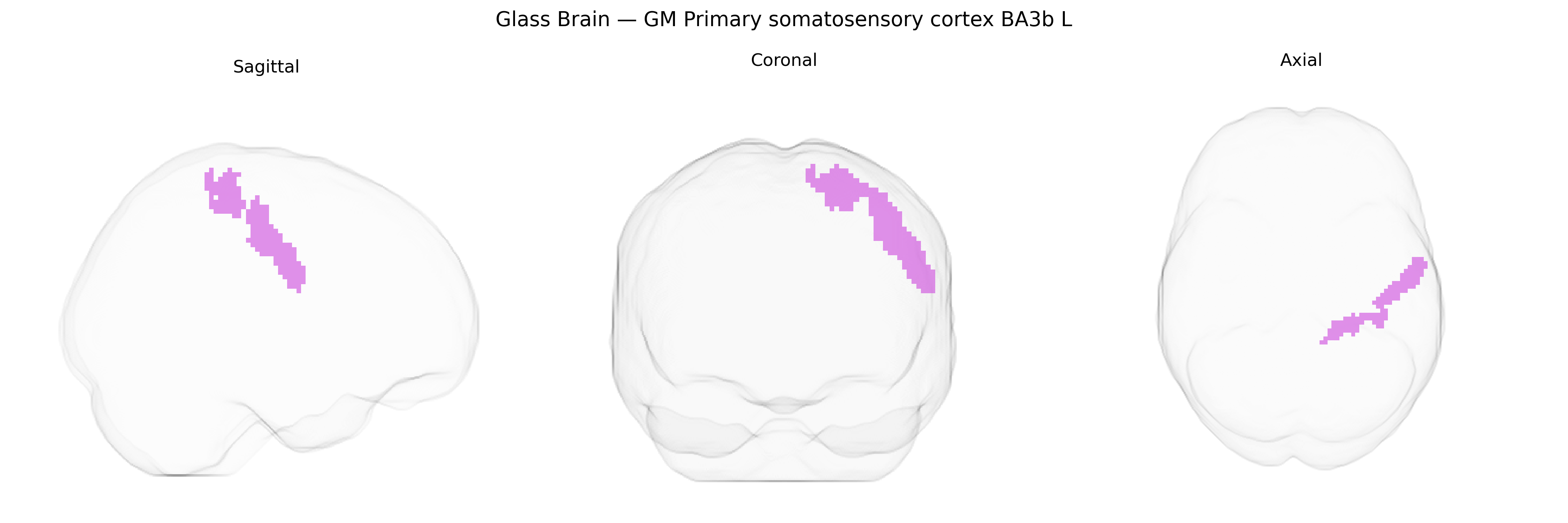 Triplanar Ghost Brain