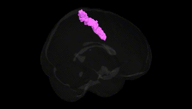 Full Brain Black