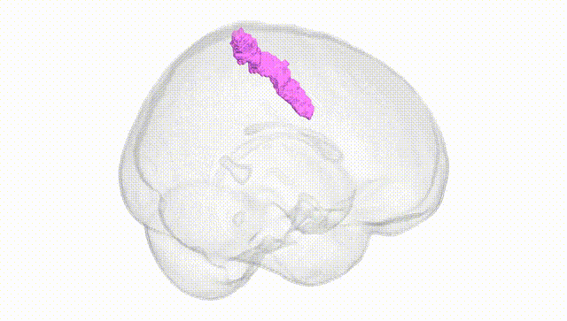 Full Brain White
