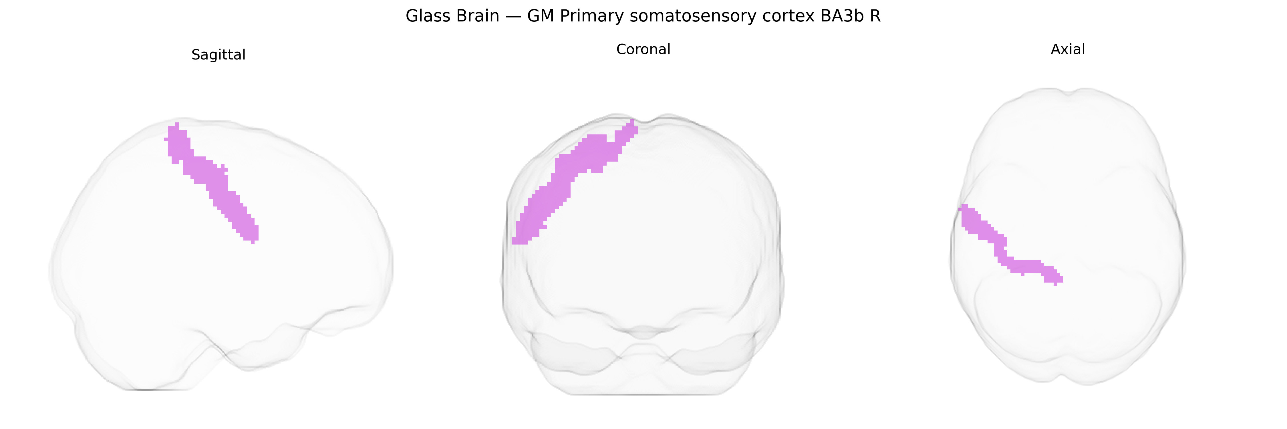 Triplanar Ghost Brain