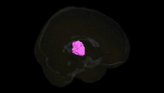 Full Brain Black