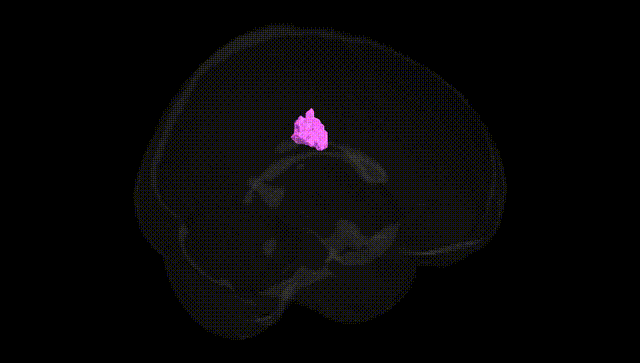 Full Brain Black