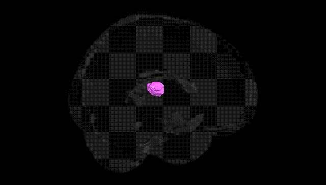 Full Brain Black