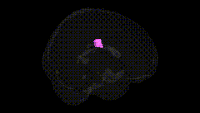 Full Brain Black
