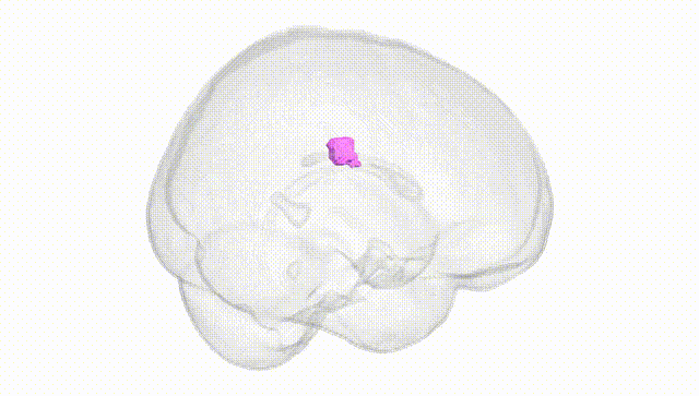 Full Brain White
