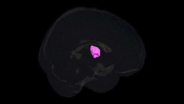 Full Brain Black