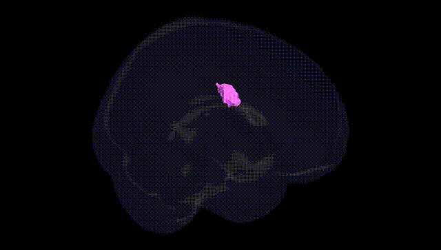 Full Brain Black