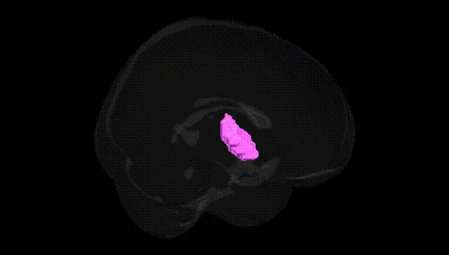 Full Brain Black