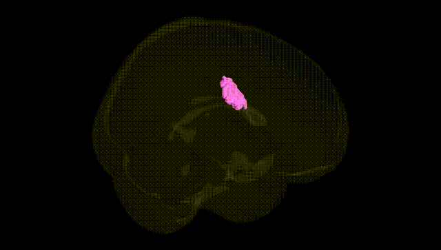 Full Brain Black
