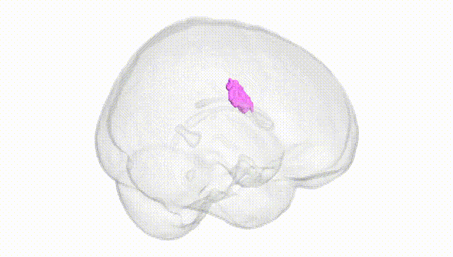 Full Brain White