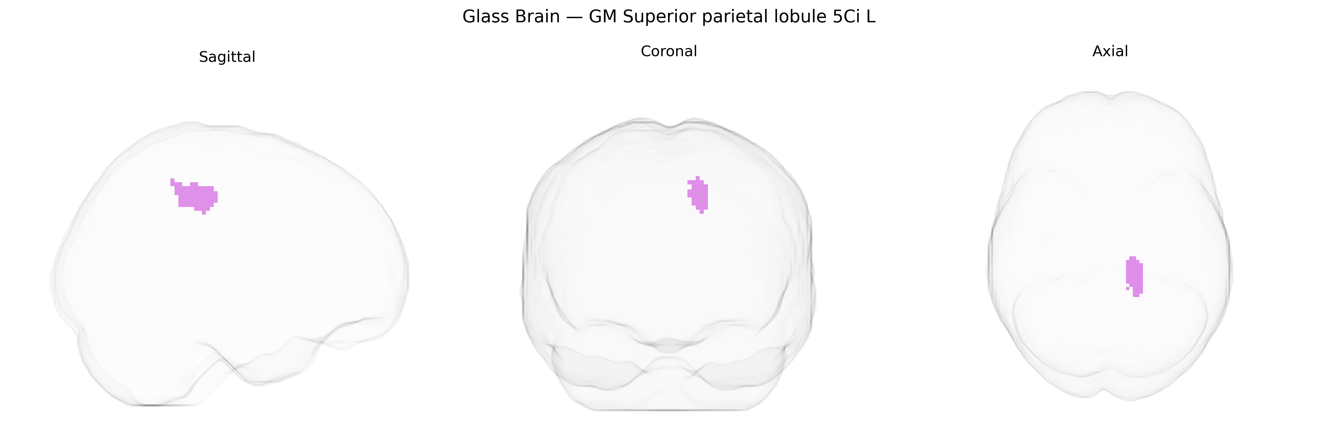 Triplanar Ghost Brain