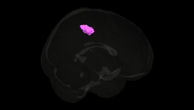 Full Brain Black