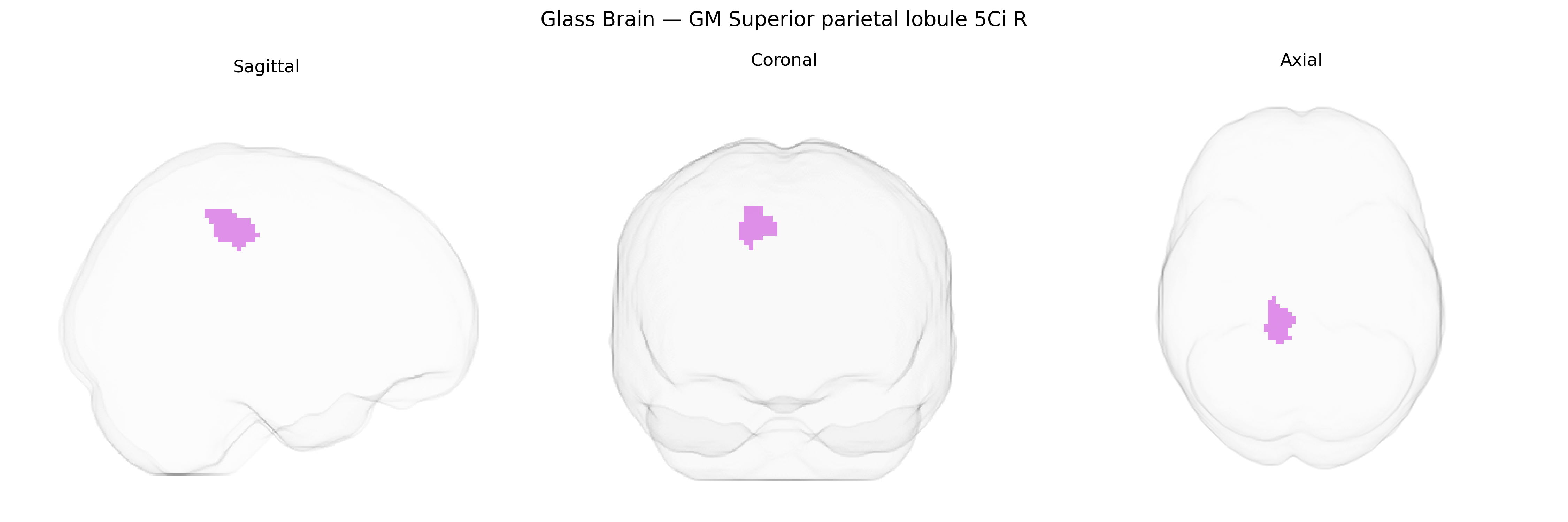 Triplanar Ghost Brain