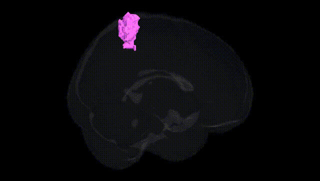 Full Brain Black