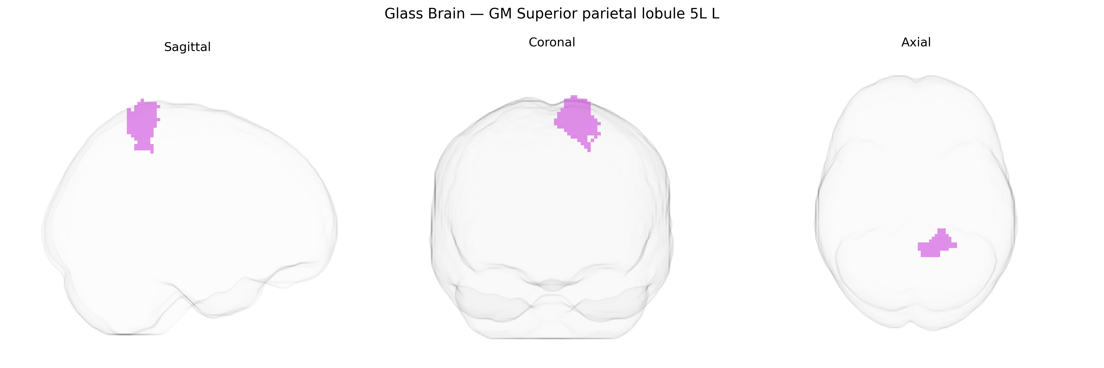 Triplanar Ghost Brain