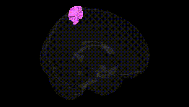 Full Brain Black