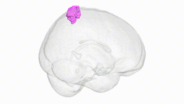 Full Brain White