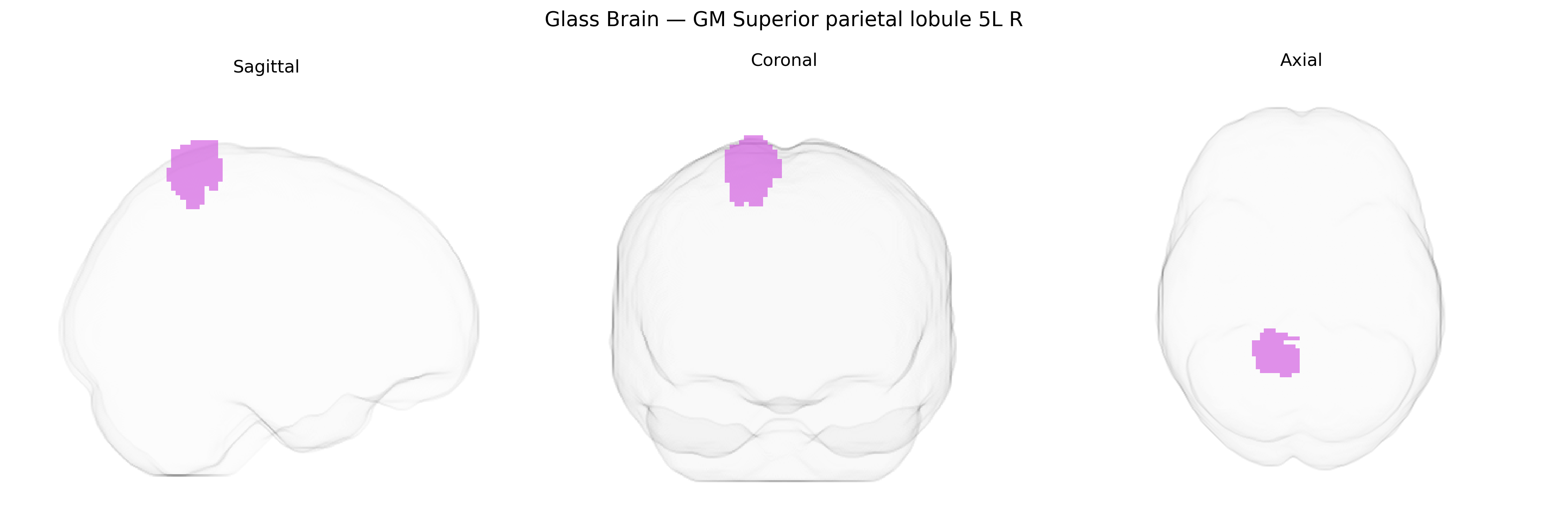 Triplanar Ghost Brain