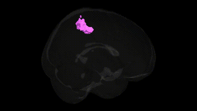 Full Brain Black