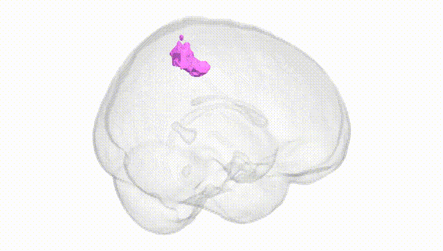 Full Brain White