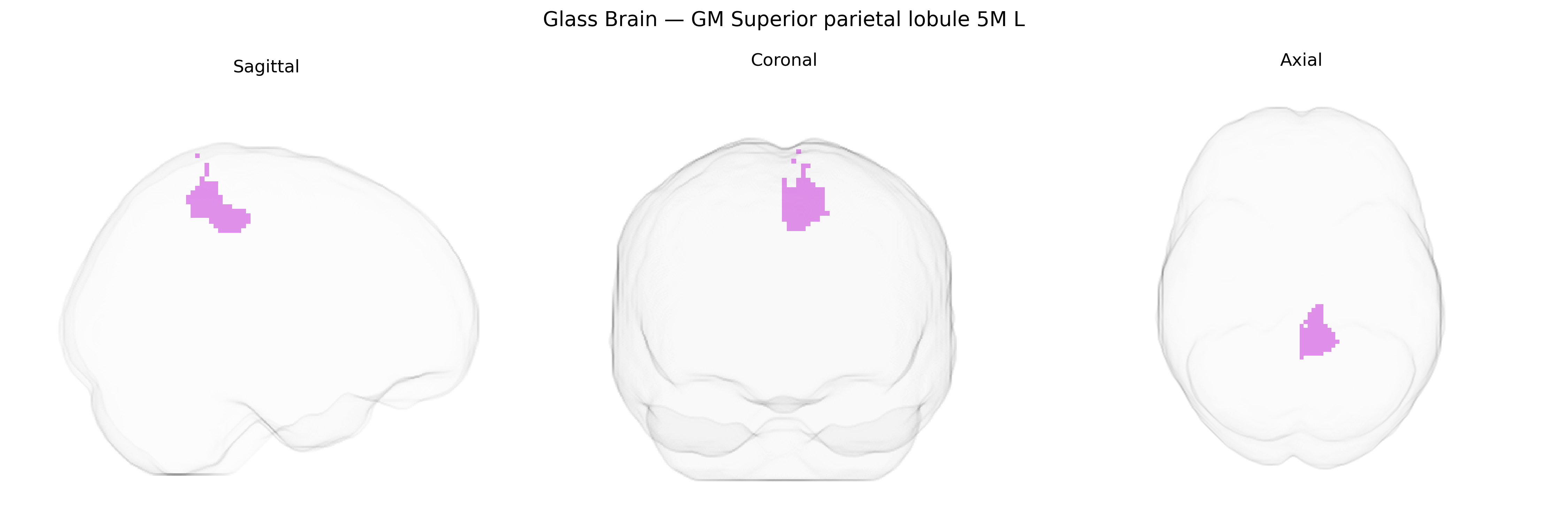 Triplanar Ghost Brain