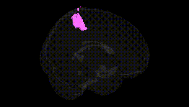 Full Brain Black