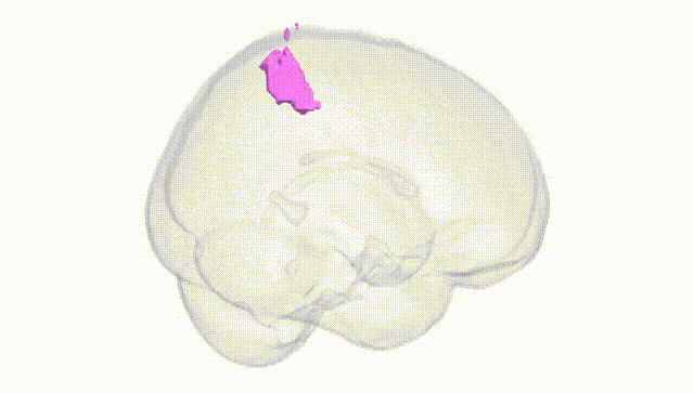 Full Brain White