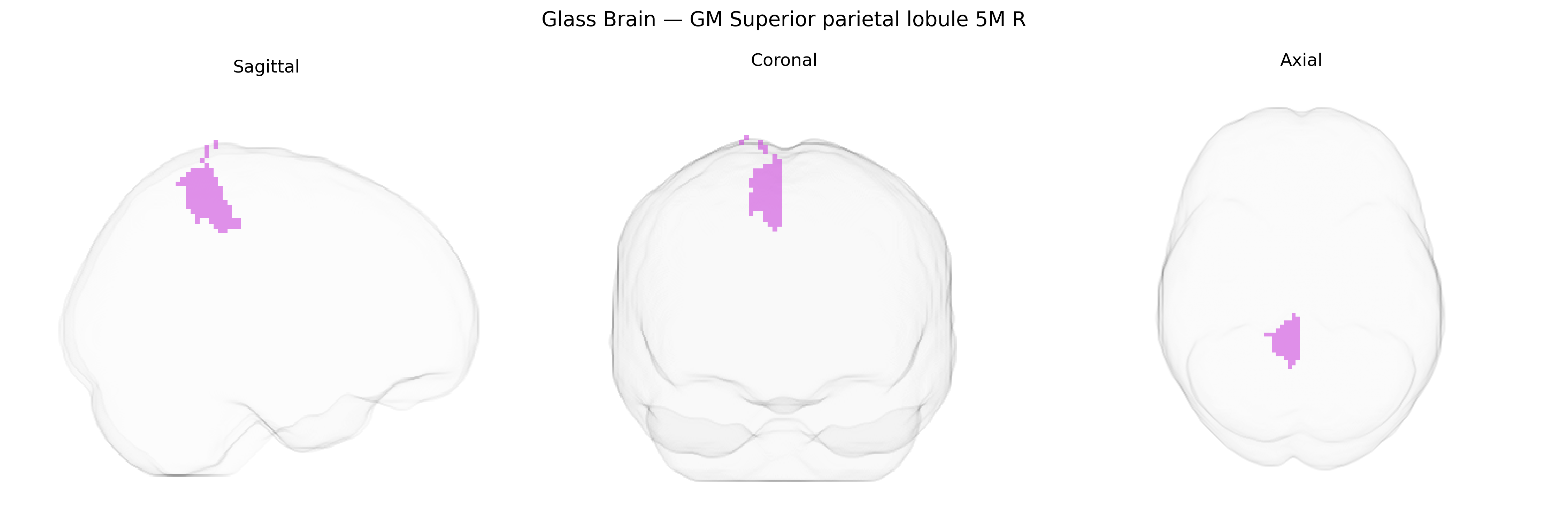 Triplanar Ghost Brain