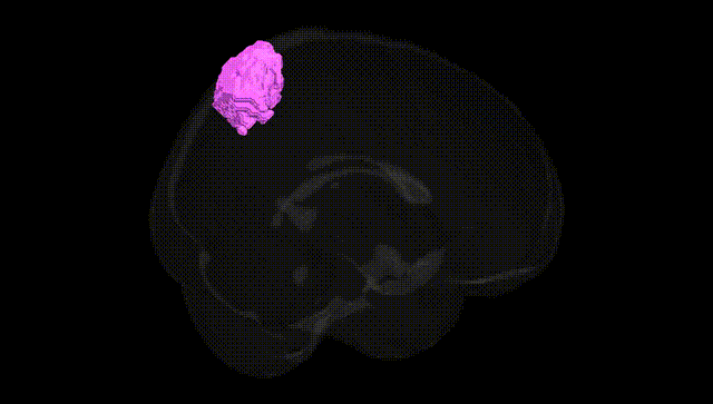 Full Brain Black
