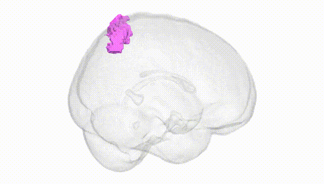 Full Brain White