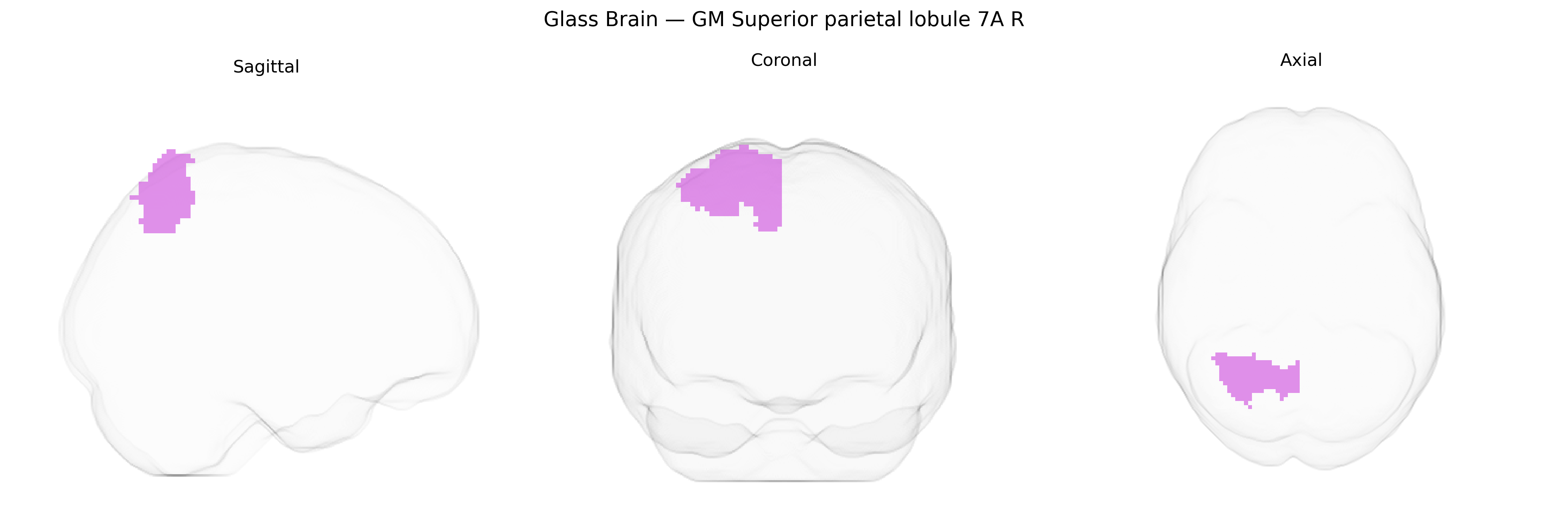Triplanar Ghost Brain