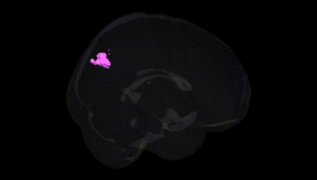 Full Brain Black