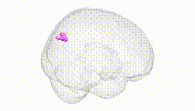 Full Brain White