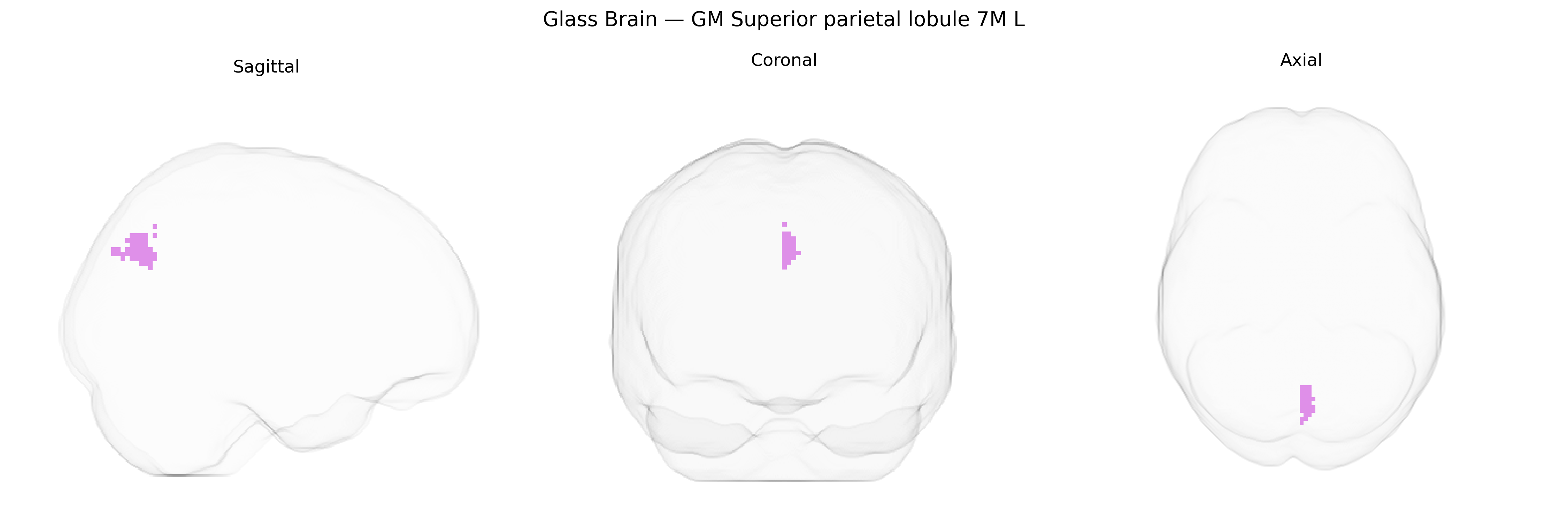 Triplanar Ghost Brain